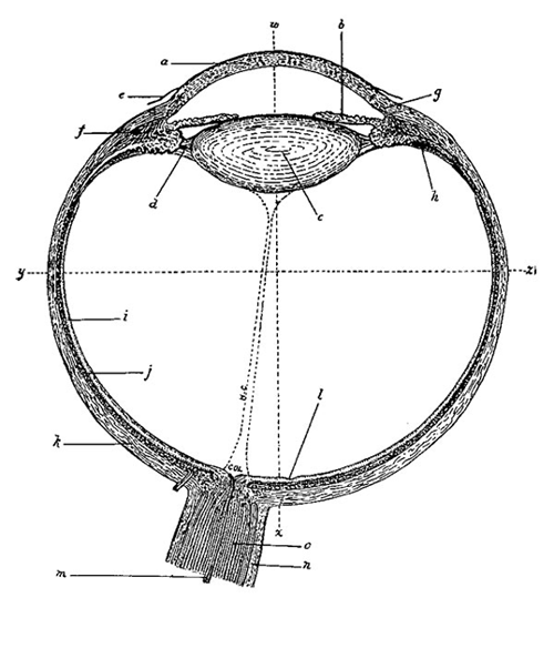 Early day Cataract diagram Early day Cataract diagram